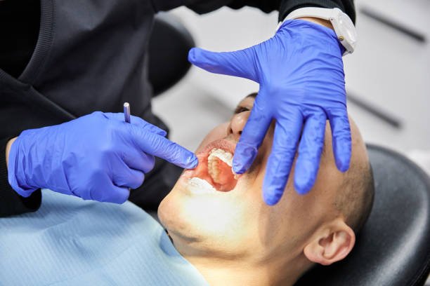 Best Emergency Gum Treatment in Zumbrota, MN